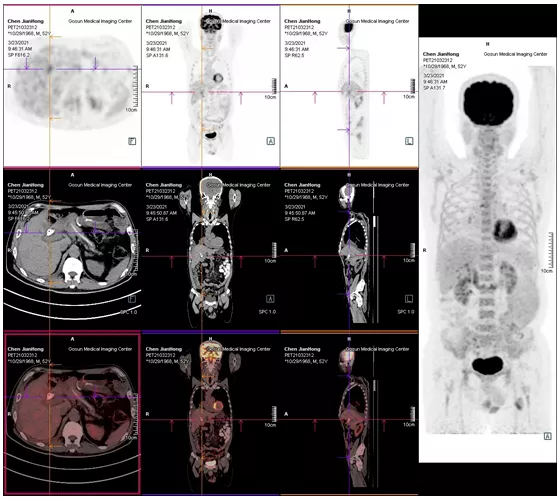 1633662754932633.png image.png